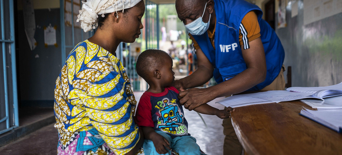 Niño con desnutrición en una revisión de rutina en Kalemie, República Democrática del Congo.
