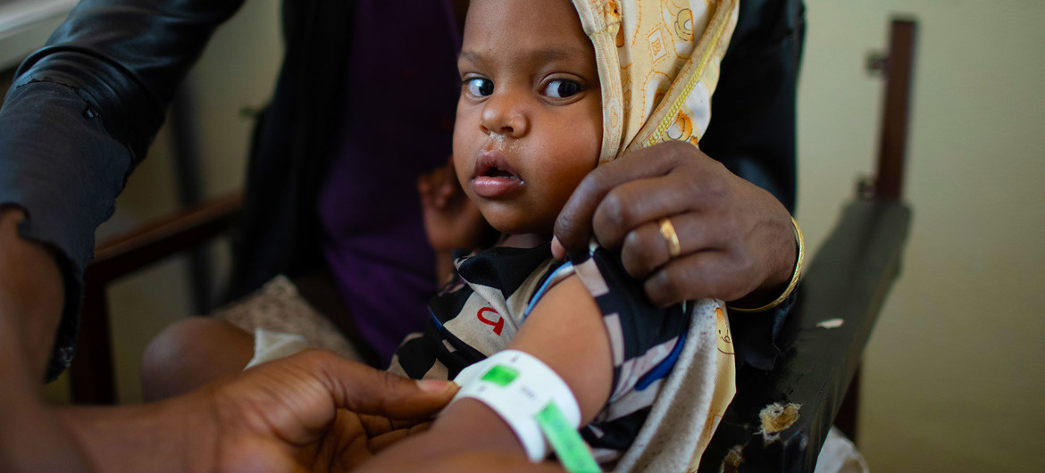 Niño en consulta por desnutrición en un centro de salud en Tigray, Etiopía.