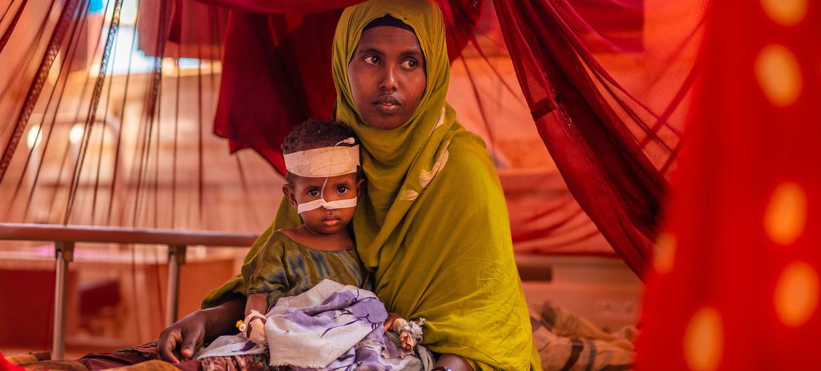 Un niño recibe un tratamiento nutricional en un hospital que cuenta con el apoyo de UNICEF en la región de Somali (Etiopía).
