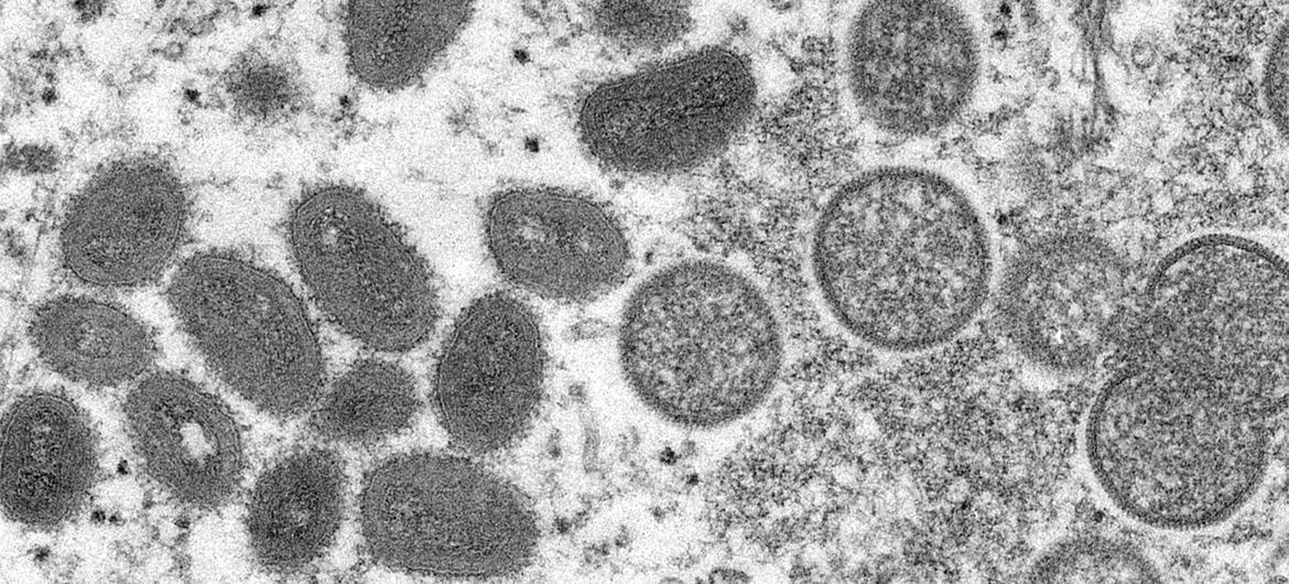 La viruela del mono es una infección rara pero peligrosa, similar al ya erradicado virus de la viruela.