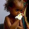 Millones de niños en Yemen están amenazados por la malnutrición y la falta de servicios básicos. Una situación causada por la guerra. 